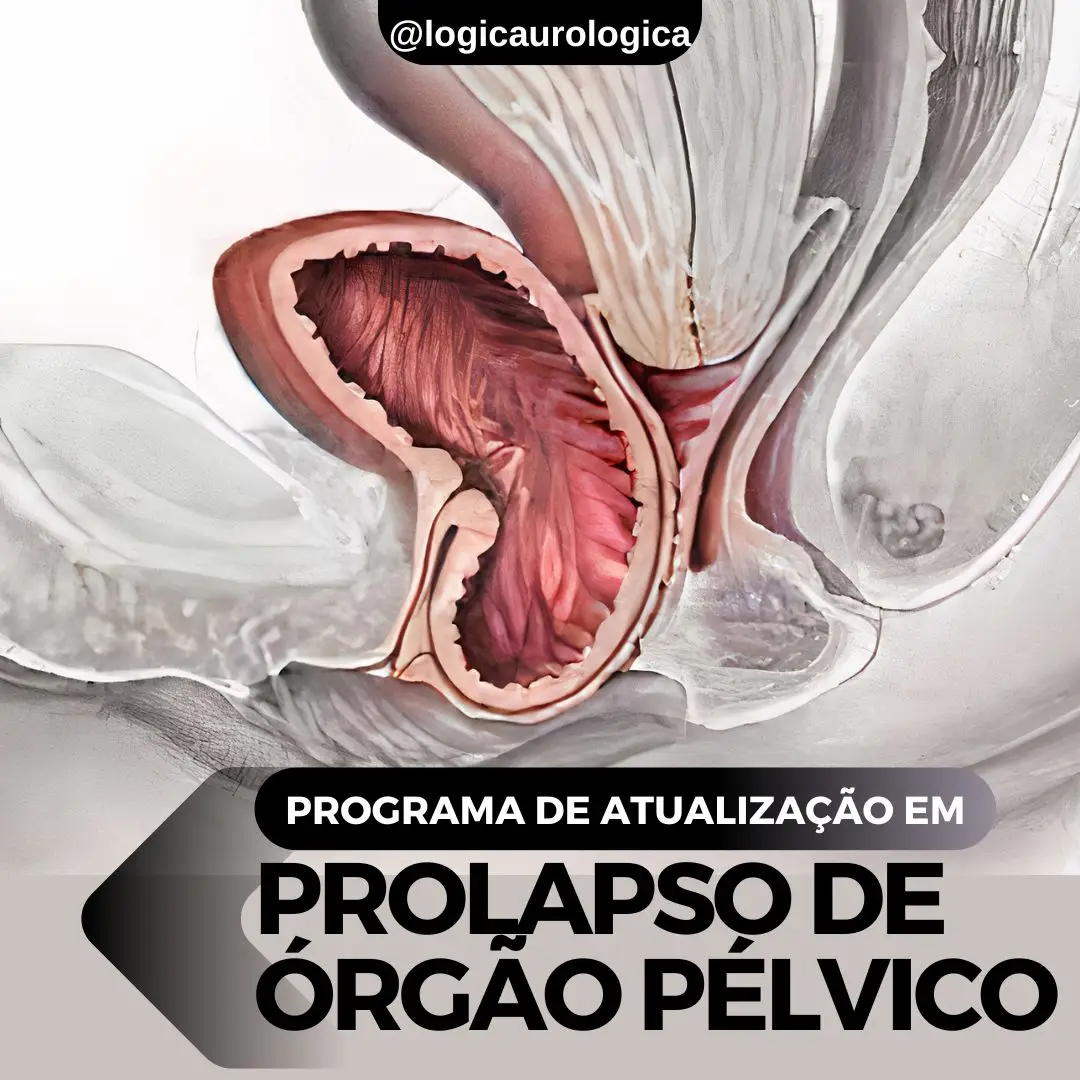 Programa de Prolapso Logo
